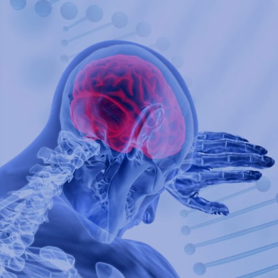 Singular Medicina de Precisão - Neurologia
