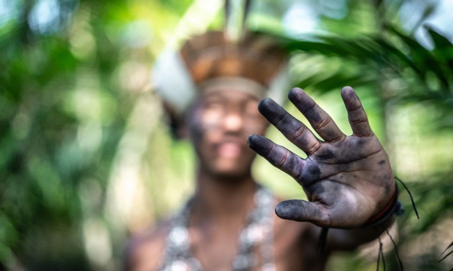 30% dessas pessoas falecem antes dos 5 anos